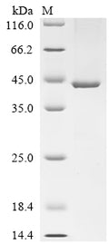 (Tris-Glycine gel) Discontinuous SDS-PAGE (reduced) with 5% enrichment gel and 15% separation gel.