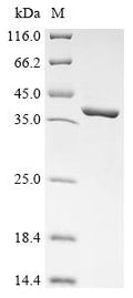 (Tris-Glycine gel) Discontinuous SDS-PAGE (reduced) with 5% enrichment gel and 15% separation gel.