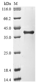 (Tris-Glycine gel) Discontinuous SDS-PAGE (reduced) with 5% enrichment gel and 15% separation gel.