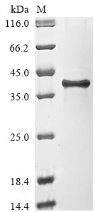 (Tris-Glycine gel) Discontinuous SDS-PAGE (reduced) with 5% enrichment gel and 15% separation gel.
