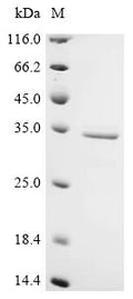 (Tris-Glycine gel) Discontinuous SDS-PAGE (reduced) with 5% enrichment gel and 15% separation gel.