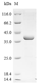 (Tris-Glycine gel) Discontinuous SDS-PAGE (reduced) with 5% enrichment gel and 15% separation gel.