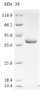 (Tris-Glycine gel) Discontinuous SDS-PAGE (reduced) with 5% enrichment gel and 15% separation gel.