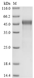 (Tris-Glycine gel) Discontinuous SDS-PAGE (reduced) with 5% enrichment gel and 15% separation gel.