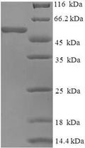 Recombinant Human coronavirus OC43 Spike glycoprotein (S), partial – Figure 1 of 1