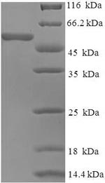 Recombinant Human coronavirus OC43 Spike glycoprotein (S), partial – Figure 1 of 1