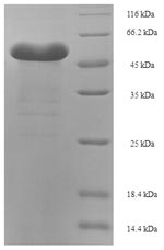 Recombinant Entamoeba histolytica Pyruvate, phosphate dikinase (PPDK), partial – Figure 1 of 1