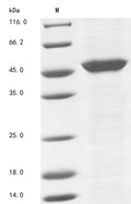 (Tris-Glycine gel) Discontinuous SDS-PAGE (reduced) with 5% enrichment gel and 15% separation gel.