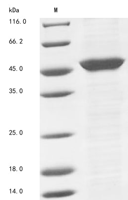 (Tris-Glycine gel) Discontinuous SDS-PAGE (reduced) with 5% enrichment gel and 15% separation gel.