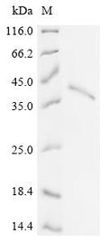 (Tris-Glycine gel) Discontinuous SDS-PAGE (reduced) with 5% enrichment gel and 15% separation gel.