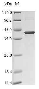(Tris-Glycine gel) Discontinuous SDS-PAGE (reduced) with 5% enrichment gel and 15% separation gel.