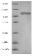 Recombinant Actinidia deliciosa Fruit protein pKIWI502 (pKIWI502) – Figure 1 of 1