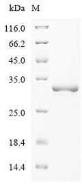 (Tris-Glycine gel) Discontinuous SDS-PAGE (reduced) with 5% enrichment gel and 15% separation gel.