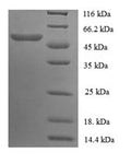 Recombinant Mouse Carboxylesterase 1C (Ces1c), partial – Figure 1 of 1