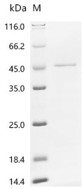 (Tris-Glycine gel) Discontinuous SDS-PAGE (reduced) with 5% enrichment gel and 15% separation gel.