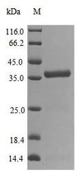 (Tris-Glycine gel) Discontinuous SDS-PAGE (reduced) with 5% enrichment gel and 15% separation gel.