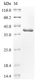(Tris-Glycine gel) Discontinuous SDS-PAGE (reduced) with 5% enrichment gel and 15% separation gel.
