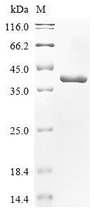 (Tris-Glycine gel) Discontinuous SDS-PAGE (reduced) with 5% enrichment gel and 15% separation gel.