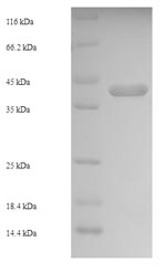(Tris-Glycine gel) Discontinuous SDS-PAGE (reduced) with 5% enrichment gel and 15% separation gel.