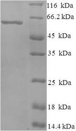 Recombinant Bovine respiratory syncytial virus Nucleoprotein (N) – Figure 1 of 1