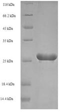 Recombinant Human papillomavirus type 52 Protein E7 (E7) – Figure 1 of 1