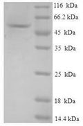 Recombinant Human GMP reductase 1 (GMPR) – Figure 1 of 1