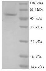 Recombinant Human GMP reductase 1 (GMPR) – Figure 1 of 1