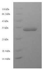 Recombinant Escherichia coli Universal stress protein F (uspF) – Figure 1 of 1