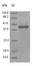 (Tris-Glycine gel) Discontinuous SDS-PAGE (reduced) with 5% enrichment gel and 15% separation gel.