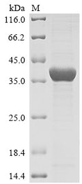 (Tris-Glycine gel) Discontinuous SDS-PAGE (reduced) with 5% enrichment gel and 15% separation gel.