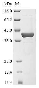 (Tris-Glycine gel) Discontinuous SDS-PAGE (reduced) with 5% enrichment gel and 15% separation gel.