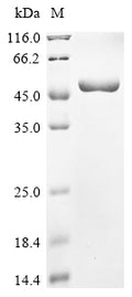 (Tris-Glycine gel) Discontinuous SDS-PAGE (reduced) with 5% enrichment gel and 15% separation gel.