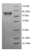 Recombinant Escherichia coli Cytosine deaminase (codA) – Figure 1 of 1