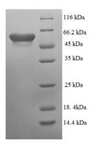 Recombinant Escherichia coli Cytosine deaminase (codA) – Figure 1 of 1