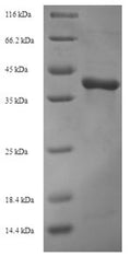 Recombinant Autographa californica nuclear polyhedrosis virus Viral cathepsin (VCATH) – Figure 1 of 1