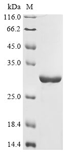 (Tris-Glycine gel) Discontinuous SDS-PAGE (reduced) with 5% enrichment gel and 15% separation gel.