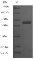 Recombinant Escherichia coli 1-acyl-sn-glycerol-3-phosphate acyltransferase (plsC) – Figure 1 of 1