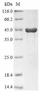 (Tris-Glycine gel) Discontinuous SDS-PAGE (reduced) with 5% enrichment gel and 15% separation gel.