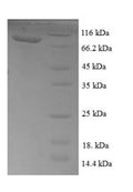 Recombinant Escherichia coli Transketolase 1 (tktA) – Figure 1 of 1