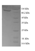 Recombinant Escherichia coli Transketolase 1 (tktA) – Figure 1 of 1