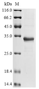 (Tris-Glycine gel) Discontinuous SDS-PAGE (reduced) with 5% enrichment gel and 15% separation gel.