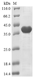 (Tris-Glycine gel) Discontinuous SDS-PAGE (reduced) with 5% enrichment gel and 15% separation gel.