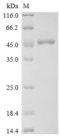 (Tris-Glycine gel) Discontinuous SDS-PAGE (reduced) with 5% enrichment gel and 15% separation gel.