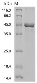 (Tris-Glycine gel) Discontinuous SDS-PAGE (reduced) with 5% enrichment gel and 15% separation gel.