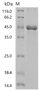 (Tris-Glycine gel) Discontinuous SDS-PAGE (reduced) with 5% enrichment gel and 15% separation gel.