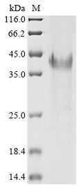 (Tris-Glycine gel) Discontinuous SDS-PAGE (reduced) with 5% enrichment gel and 15% separation gel.