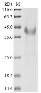 (Tris-Glycine gel) Discontinuous SDS-PAGE (reduced) with 5% enrichment gel and 15% separation gel.