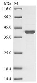 (Tris-Glycine gel) Discontinuous SDS-PAGE (reduced) with 5% enrichment gel and 15% separation gel.