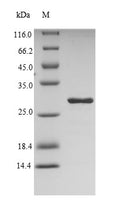 Recombinant Dermatophagoides pteronyssinus Mite group 2 allergen Der p 2 (DERP2) – Figure 1 of 1
