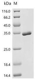 (Tris-Glycine gel) Discontinuous SDS-PAGE (reduced) with 5% enrichment gel and 15% separation gel.